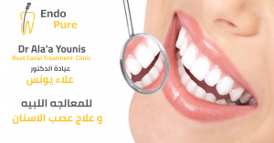 عيادة الدكتور علاء يونس اخصائي عصب اسنان